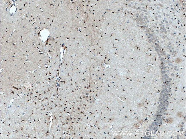 SOX2 Antibody in Immunohistochemistry (Paraffin) (IHC (P))