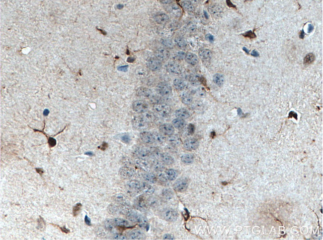 SOX2 Antibody in Immunohistochemistry (Paraffin) (IHC (P))