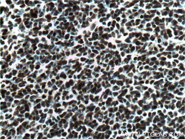 SOX2 Antibody in Immunohistochemistry (Paraffin) (IHC (P))