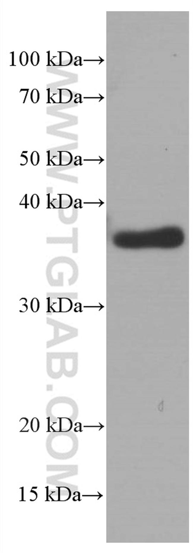 SOX2 Antibody in Western Blot (WB)