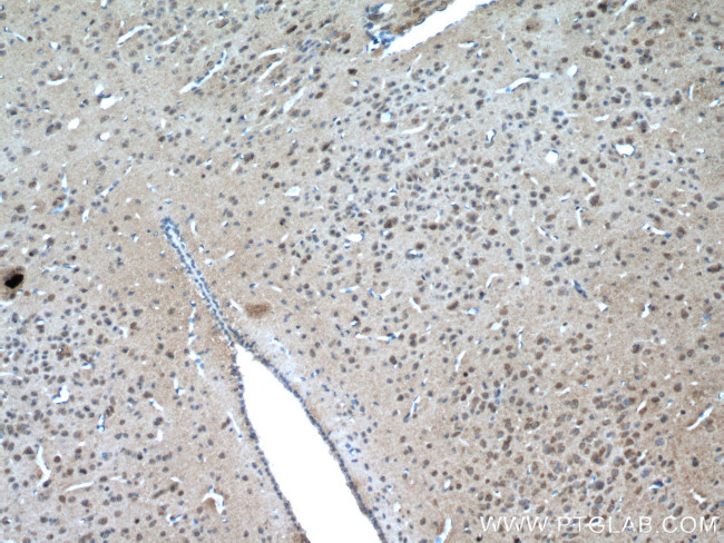 a-Synuclein Antibody in Immunohistochemistry (Paraffin) (IHC (P))