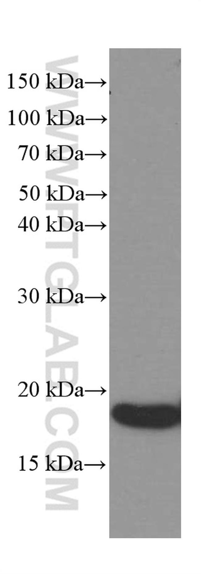 a-Synuclein Antibody in Western Blot (WB)