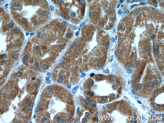 ZC3HAV1 Antibody in Immunohistochemistry (Paraffin) (IHC (P))