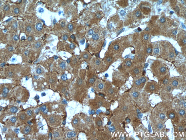 LDLR Antibody in Immunohistochemistry (Paraffin) (IHC (P))