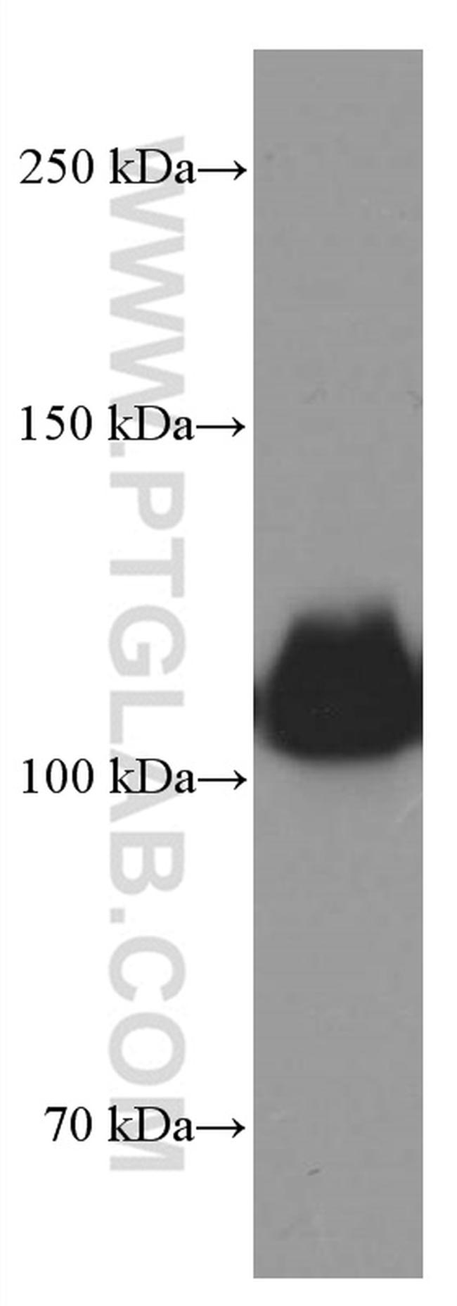 LDLR Antibody in Western Blot (WB)