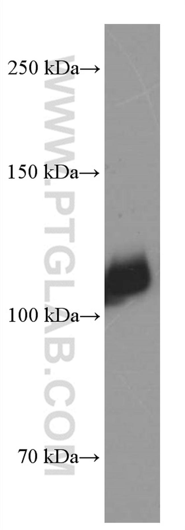 LDLR Antibody in Western Blot (WB)
