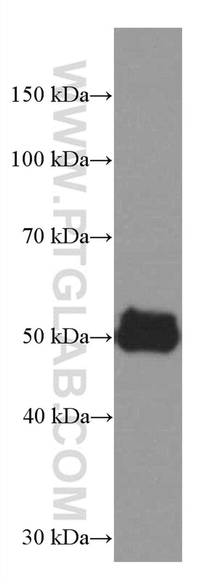 AGTR1 Antibody in Western Blot (WB)