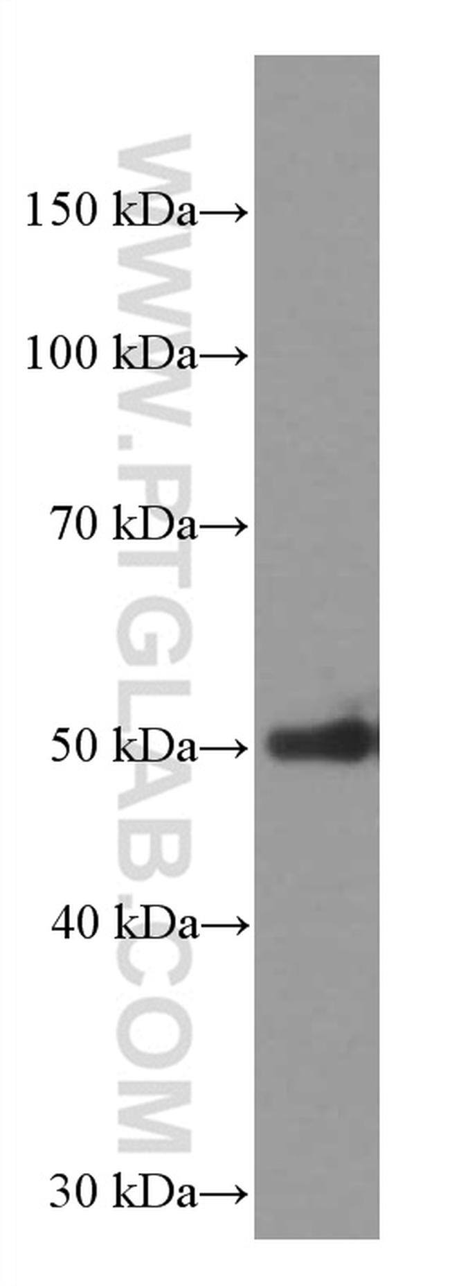 AGTR1 Antibody in Western Blot (WB)