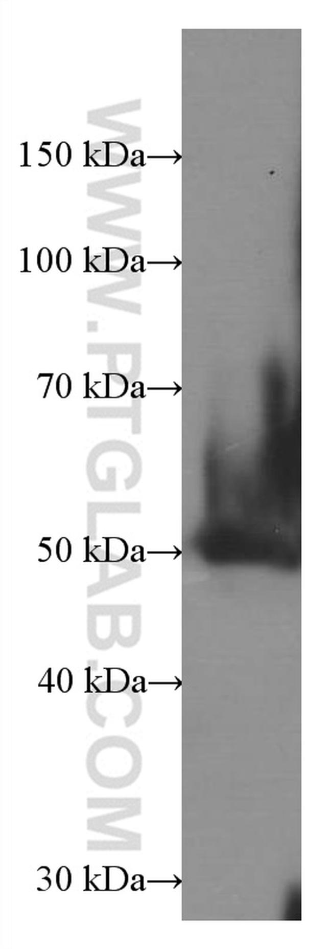 AGTR1 Antibody in Western Blot (WB)