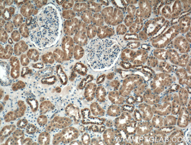 P2RX4 Antibody in Immunohistochemistry (Paraffin) (IHC (P))