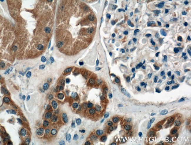 P2RX4 Antibody in Immunohistochemistry (Paraffin) (IHC (P))