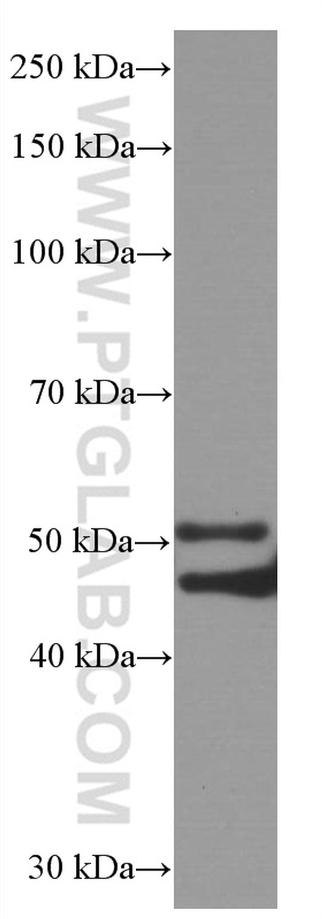 P2RX4 Antibody in Western Blot (WB)