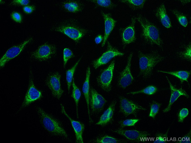 LAP3 Antibody in Immunocytochemistry (ICC/IF)