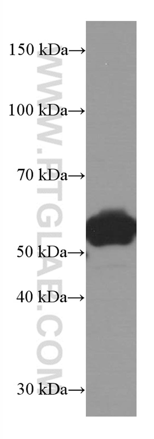 LAP3 Antibody in Western Blot (WB)