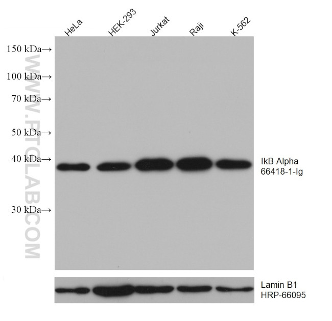 IkB alpha Antibody in Western Blot (WB)