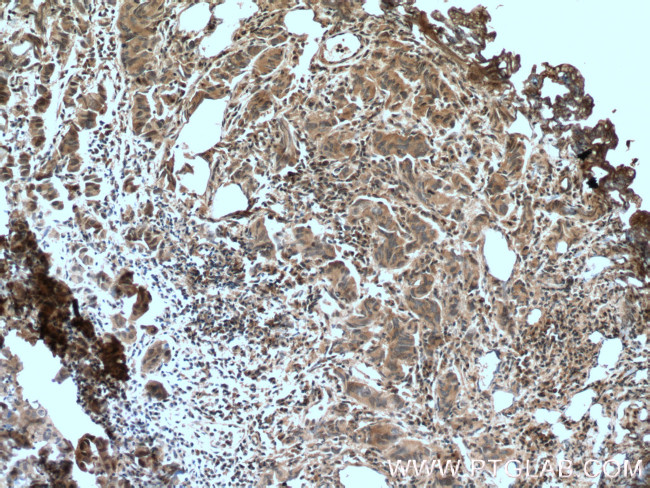 IkB alpha Antibody in Immunohistochemistry (Paraffin) (IHC (P))