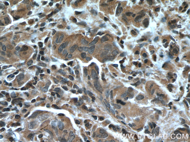 IkB alpha Antibody in Immunohistochemistry (Paraffin) (IHC (P))