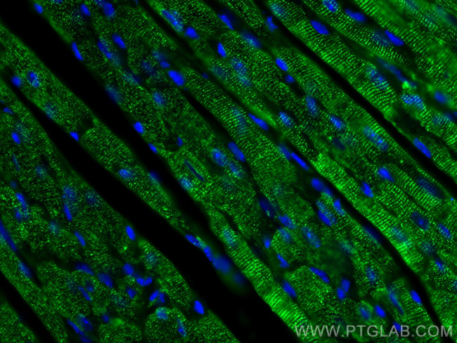 Calsequestrin 2 Antibody in Immunohistochemistry (PFA fixed) (IHC (PFA))