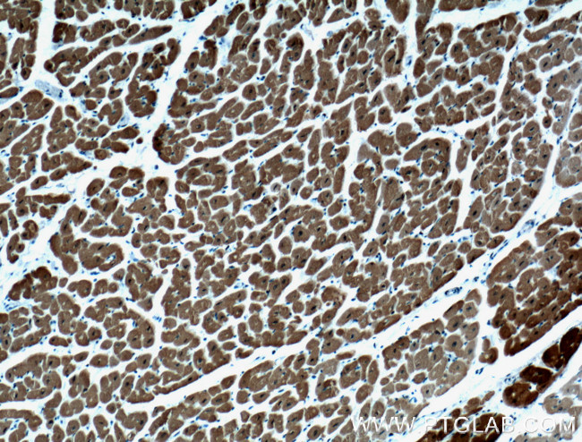 Calsequestrin 2 Antibody in Immunohistochemistry (Paraffin) (IHC (P))