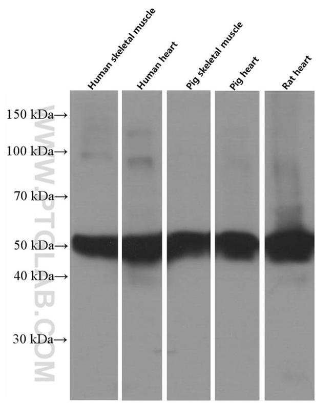 Calsequestrin 2 Antibody in Western Blot (WB)