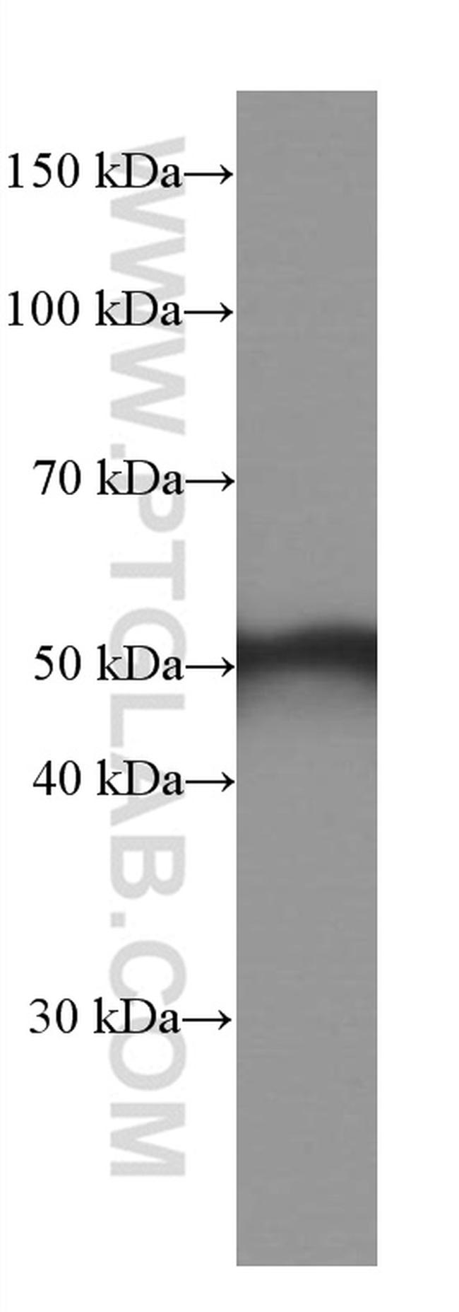 Calsequestrin 2 Antibody in Western Blot (WB)