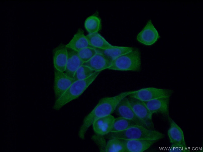 PKC alpha Antibody in Immunocytochemistry (ICC/IF)