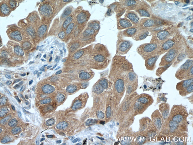 PKC alpha Antibody in Immunohistochemistry (Paraffin) (IHC (P))