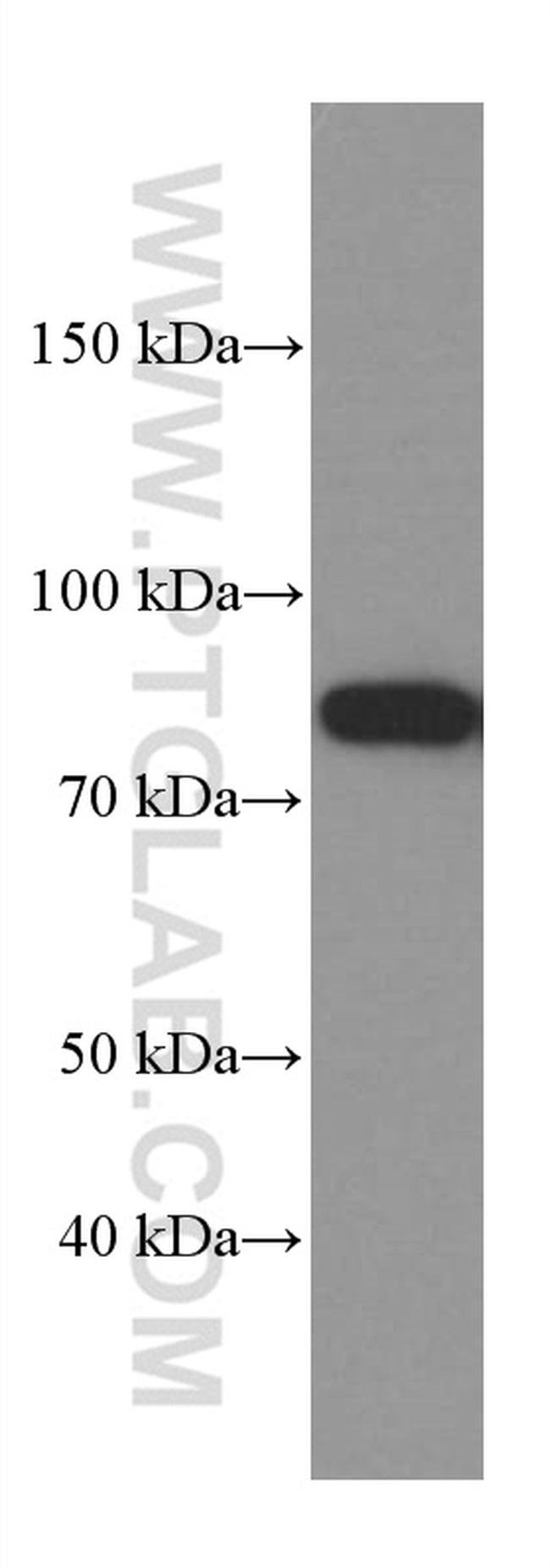 PKC alpha Antibody in Western Blot (WB)