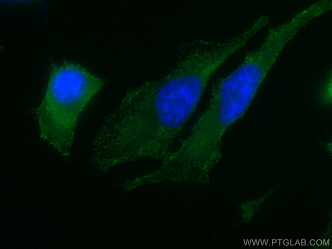 PKC alpha Antibody in Immunocytochemistry (ICC/IF)