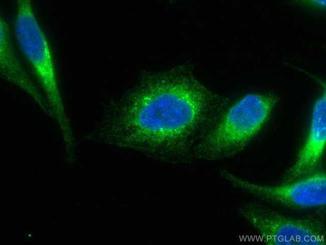 PDI Antibody in Immunocytochemistry (ICC/IF)