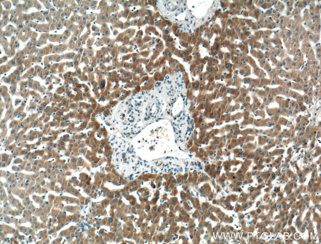 PDI Antibody in Immunohistochemistry (Paraffin) (IHC (P))