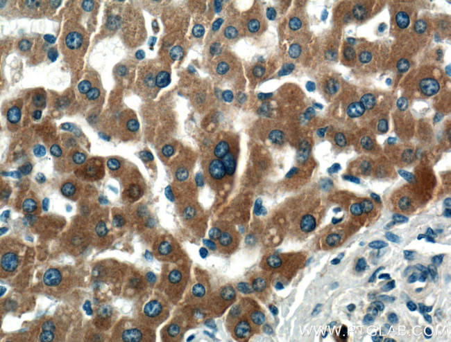 PDI Antibody in Immunohistochemistry (Paraffin) (IHC (P))