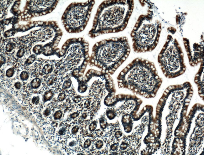 PDI Antibody in Immunohistochemistry (Paraffin) (IHC (P))