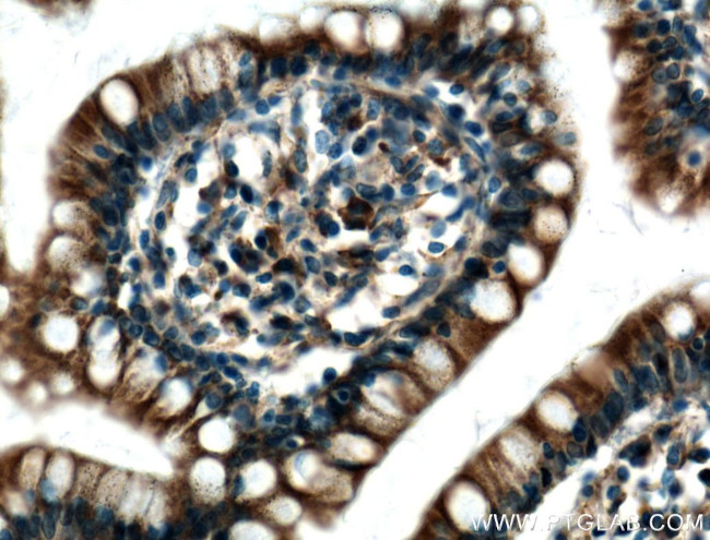 PDI Antibody in Immunohistochemistry (Paraffin) (IHC (P))