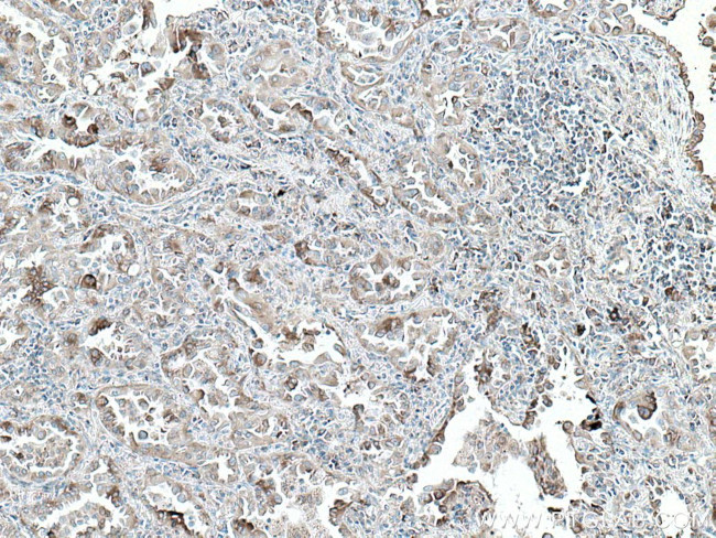 PDIA3 Antibody in Immunohistochemistry (Paraffin) (IHC (P))