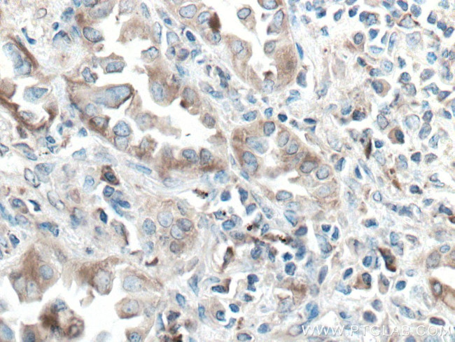 PDIA3 Antibody in Immunohistochemistry (Paraffin) (IHC (P))