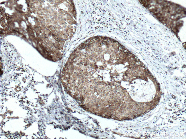 Prohibitin 2 Antibody in Immunohistochemistry (Paraffin) (IHC (P))