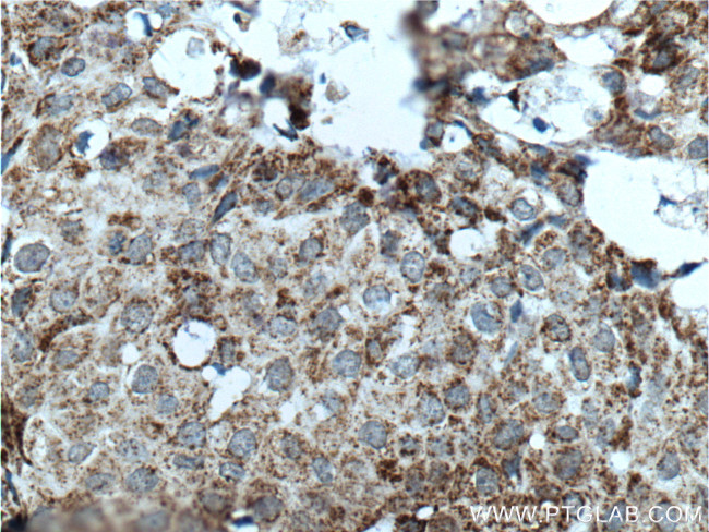 Prohibitin 2 Antibody in Immunohistochemistry (Paraffin) (IHC (P))