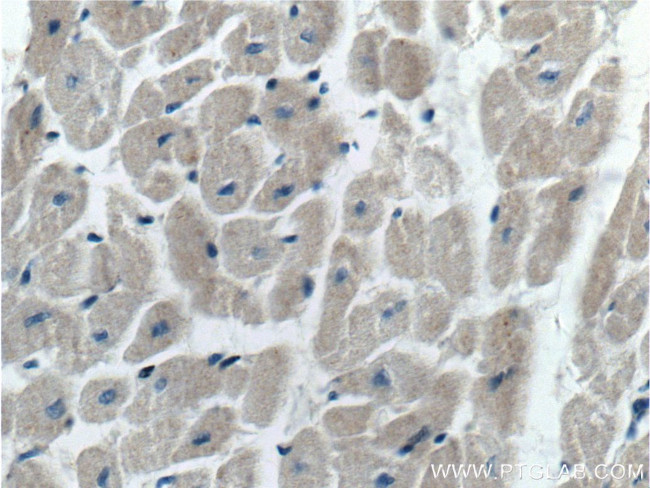 Prohibitin 2 Antibody in Immunohistochemistry (Paraffin) (IHC (P))