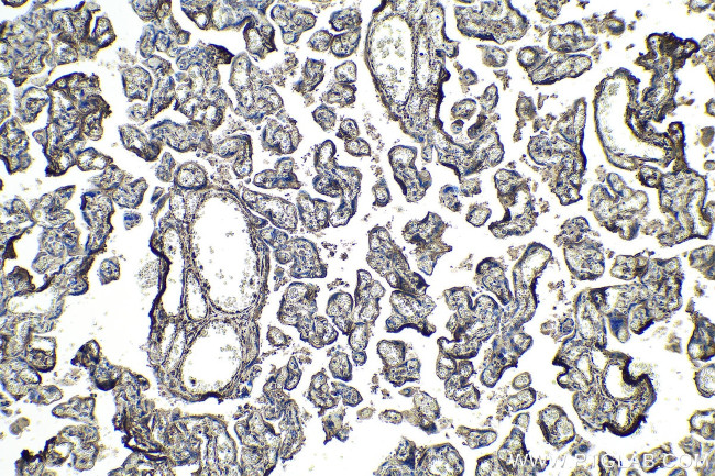 SPARC Antibody in Immunohistochemistry (Paraffin) (IHC (P))