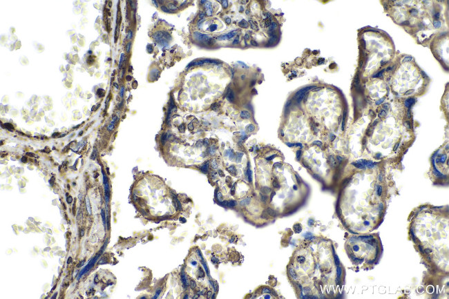 SPARC Antibody in Immunohistochemistry (Paraffin) (IHC (P))