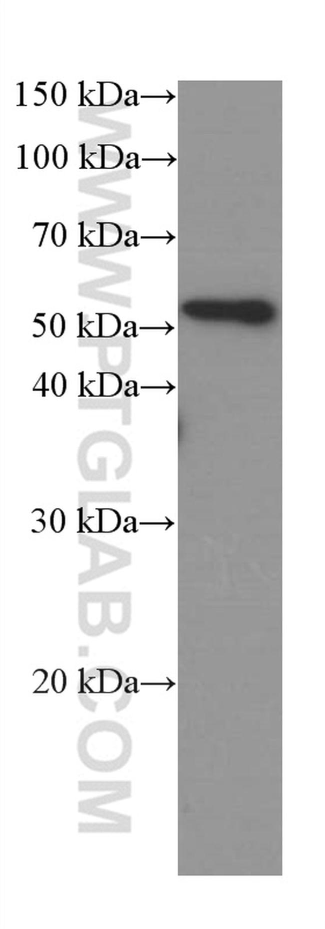 SPARC Antibody in Western Blot (WB)