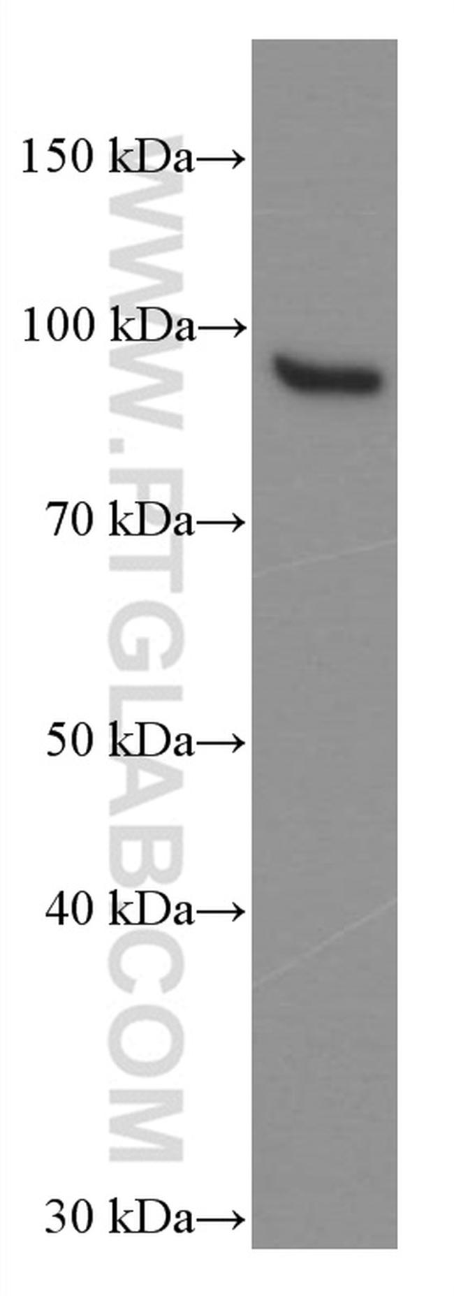 STAT5B Antibody in Western Blot (WB)