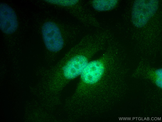 STAT5B Antibody in Immunocytochemistry (ICC/IF)