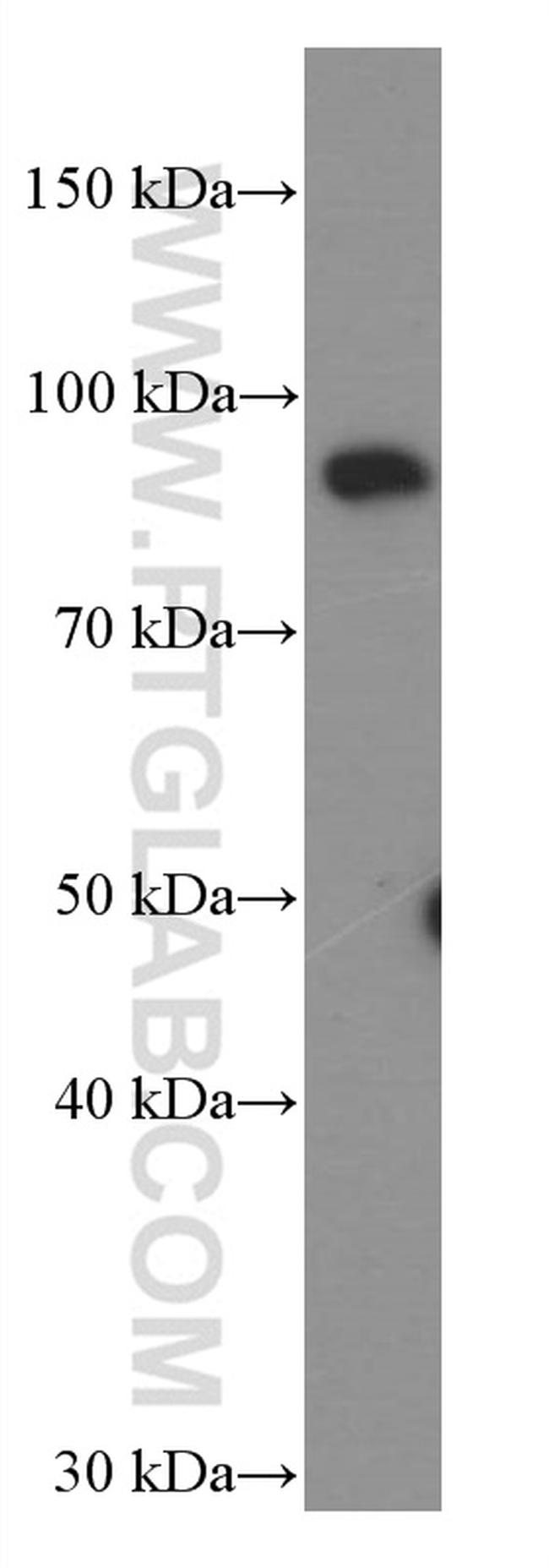 STAT5B Antibody in Western Blot (WB)