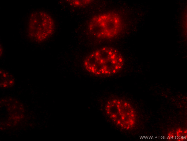 FOXO3A Antibody in Immunocytochemistry (ICC/IF)