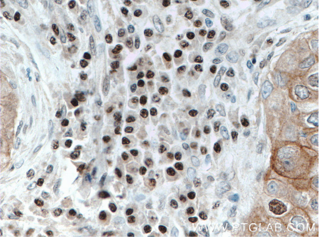 FOXO3A Antibody in Immunohistochemistry (Paraffin) (IHC (P))