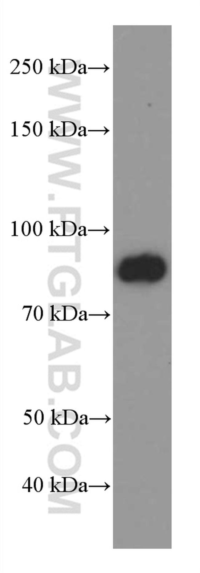 FOXO3A Antibody in Western Blot (WB)