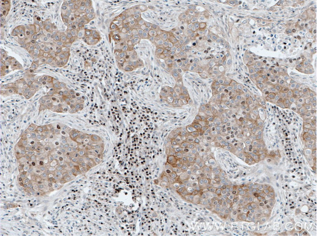 FOXO3A Antibody in Immunohistochemistry (Paraffin) (IHC (P))