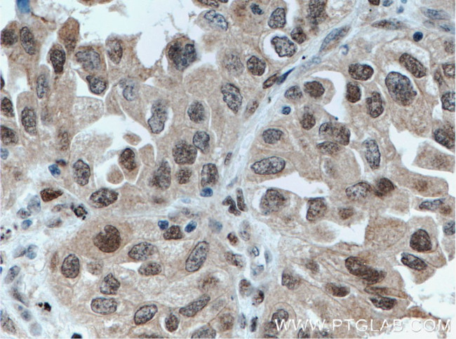 FOXO3A Antibody in Immunohistochemistry (Paraffin) (IHC (P))